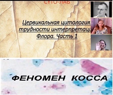 Цервикальная цитология: трудности интерпретации. ЧАСТЬ 1 157046